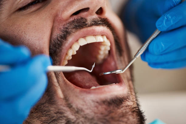 Best Tooth Infection Emergency Dentist  in Hartshorne, OK